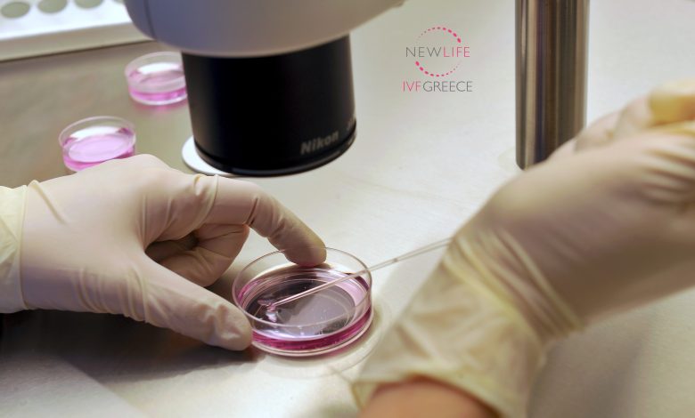 Kako vantelesna oplodnja izgleda u klinici Newlife IVF Greece