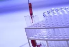 biohemijski markeri u trudnoci