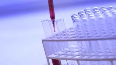 biohemijski markeri u trudnoci