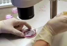 Kako vantelesna oplodnja izgleda u klinici Newlife IVF Greece