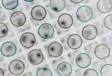 Koji je najbolji neinvanzivni prenatalni test